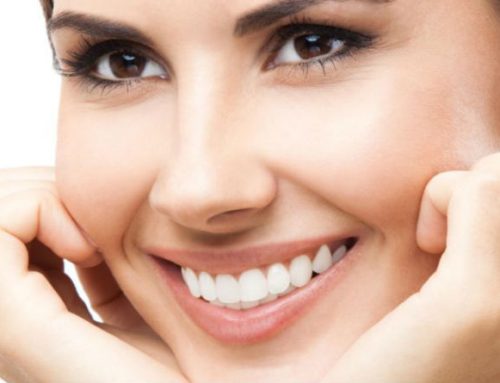 Ortodoncia y diseño de sonrisa
