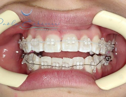 9 Tips para una ortodoncia exitosa